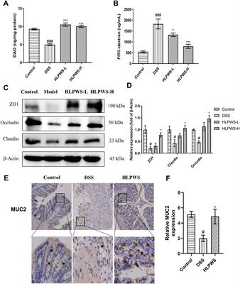 Protective effect of Huanglian Pingwei San on DSS-induced ulcerative colitis in mice through amelioration of the inflammatory response and oxidative stress